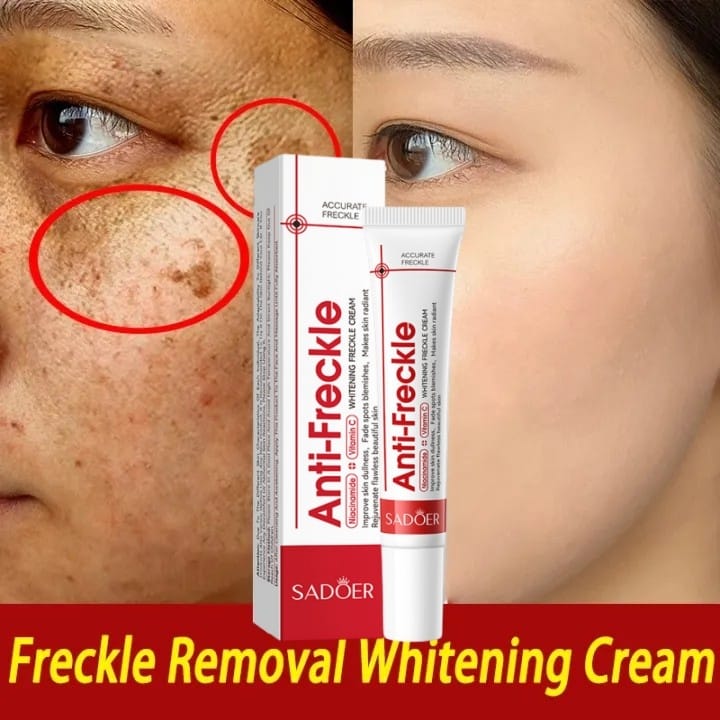 Crema quita Manchas y Pecas