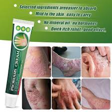 Crema psoriasis